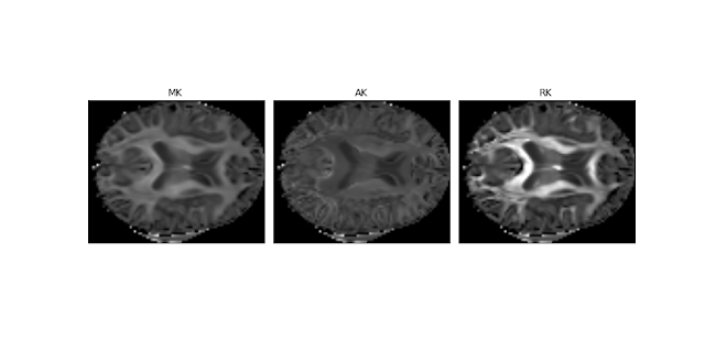 Improved Kurtosis Maps